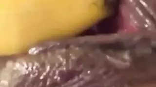 تقوية العضام