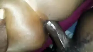 متحول جنسي تجميع الوجه الجبهة الشرج الجنس