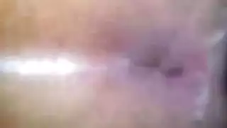 حركة شرجية ثلاثية صعبة