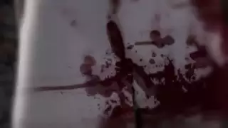 توسع الشرج واخترق