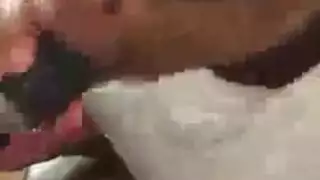 فتحة واسعة: تمديد شرجي صعب