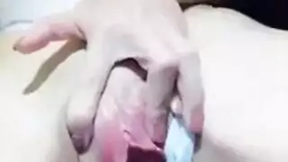 الكي لا يتحمل